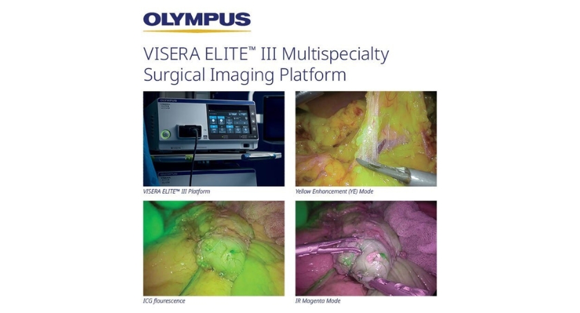 Olympus Releases Visera Elite III Surgical Imaging Platform in U.S.